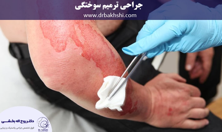 جراحی ترمیم سوختگی