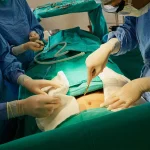 عمل ترمیم سوختگی