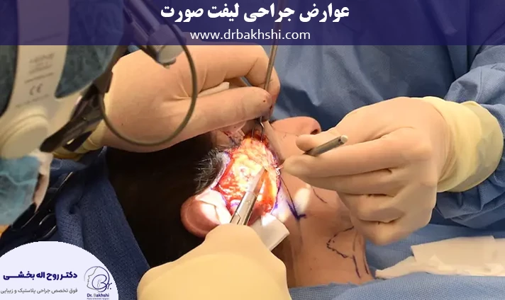 عوارض جراحی لیفت صورت