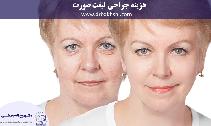 فاکتورهای موثر در هزینه جراحی لیفت صورت