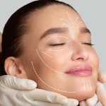 هزینه جراحی لیفت صورت