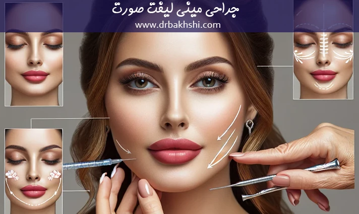 جراحی مینی لیفت صورت