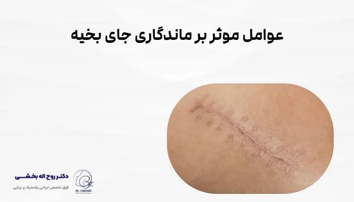 عوامل موثر بر ماندگاری جای بخیه