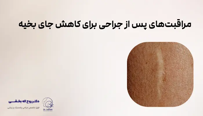 مراقبتهای پس از جراحی برای کاهش جای بخیه