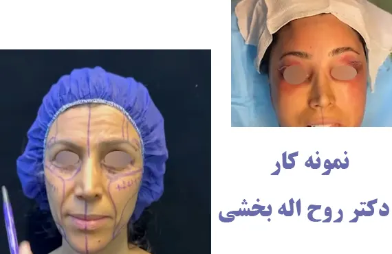 نمونه کار دکتر روح اله بخشی نمونه کار دکتر روح اله بخشی