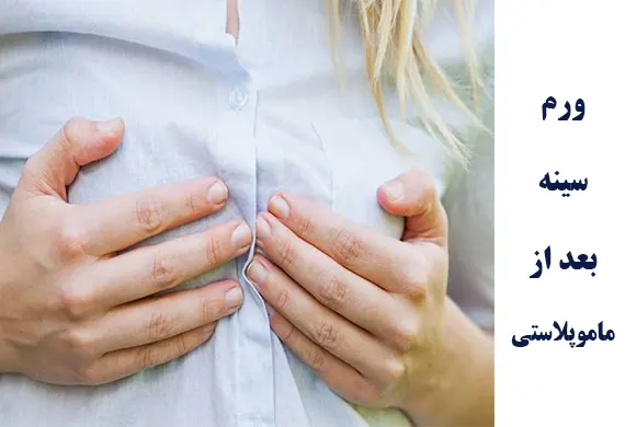 ورم سینه بعد ماموپلاستی