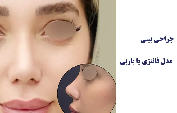 جراحی بینی مدل فانتزی