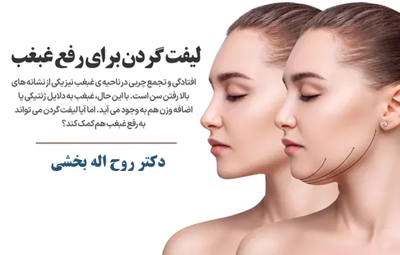 جراحی لیفت گردن