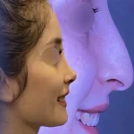 عمل بینی عروسکی