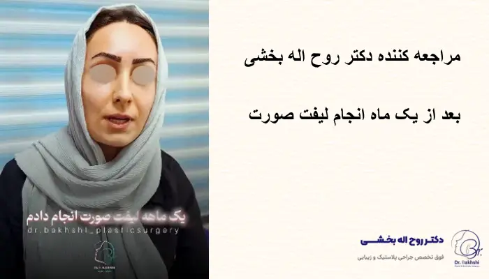 عکس لیفت صورت نمونه کار لیفت صورت دکتر بخشی