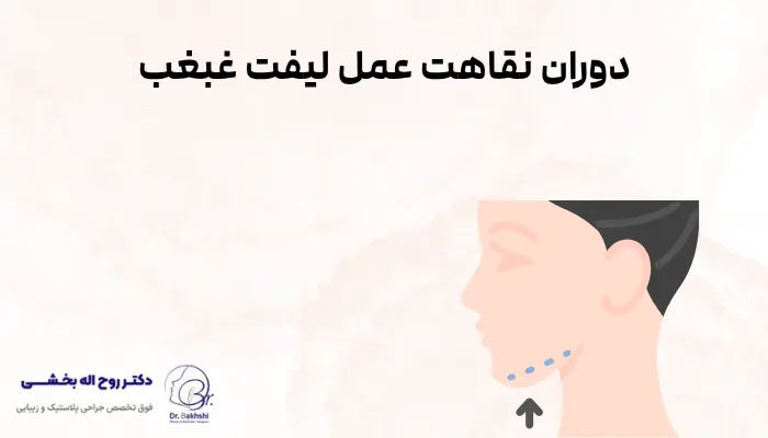 دوران  نقاهت عمل لیفت غبغب