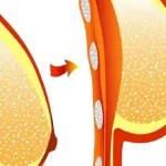 عمل لیفت پستان