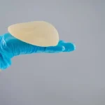 پروتز سینه مدل اشکی؛ طبیعی ترین حالت پروتز