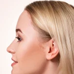 بینی استخوانی