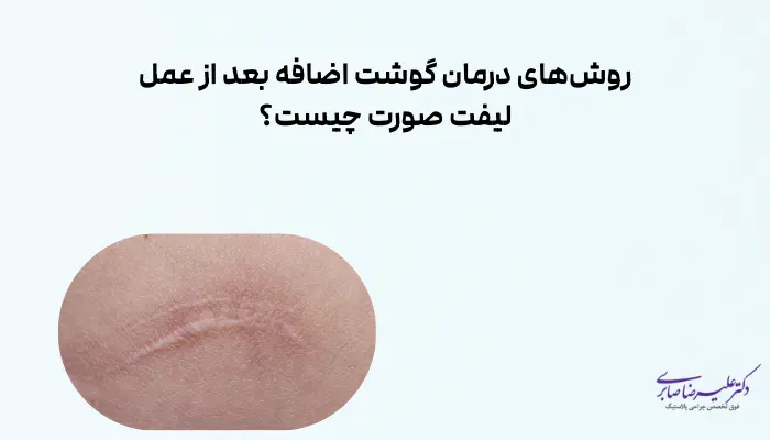 روشهای درمان گوشت اضافه بعد از عمل لیفت صورت چیست؟