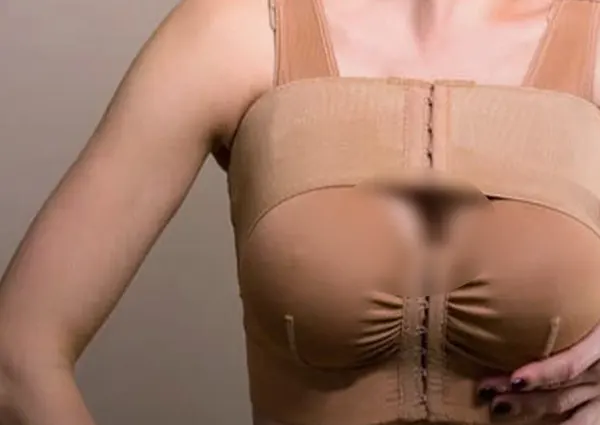 جراحی پروتز سینه