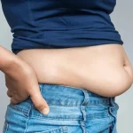 بارداری بعد از ابدومینوپلاستی: راهنمای کامل و ایمن