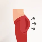 بهترین جراح پروتز باسن در تهران 1404