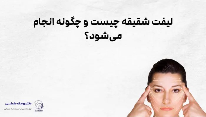 لیفت شقیقه چیست و چگونه انجام میشود؟