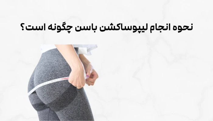 نحوه انجام لیپوساکشن باسن چگونه است؟