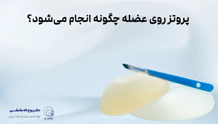 پروتز روی عضله چگونه انجام میشود؟