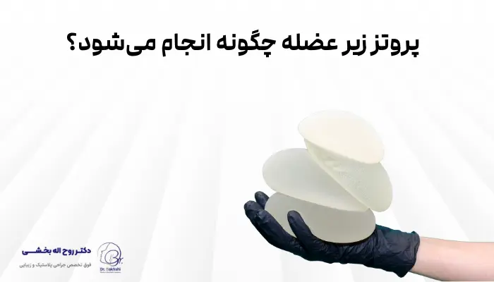 پروتز زیر عضله چگونه انجام میشود؟