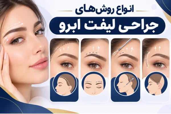 انواع روشهای جراحی لیفت ابرو