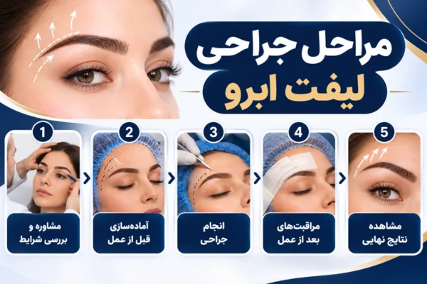 مراحل جراحی لیفت ابرو