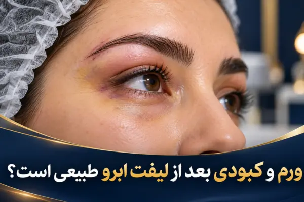ورم و کبودی بعد از لیفت ابرو طبیعی است؟