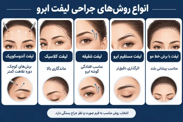 انواع روشهای جراحی لیفت ابرو کداماند؟